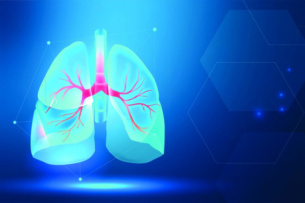 Derrame pleural: você sabe o que é? Como a tomografia de tórax pode auxiliar?