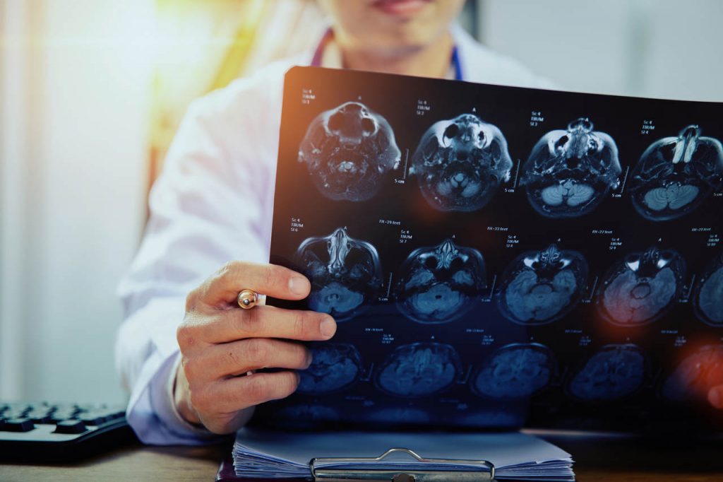 Tomografia Computadorizada é o exame de imagem mais solicitado em situações de Emergência