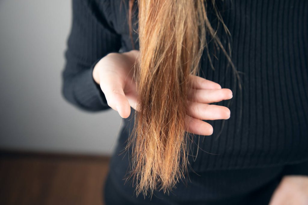 Especialista em Doenças do Cabelo e Couro Cabeludo Goiânia - O que é Intemperismo Capilar