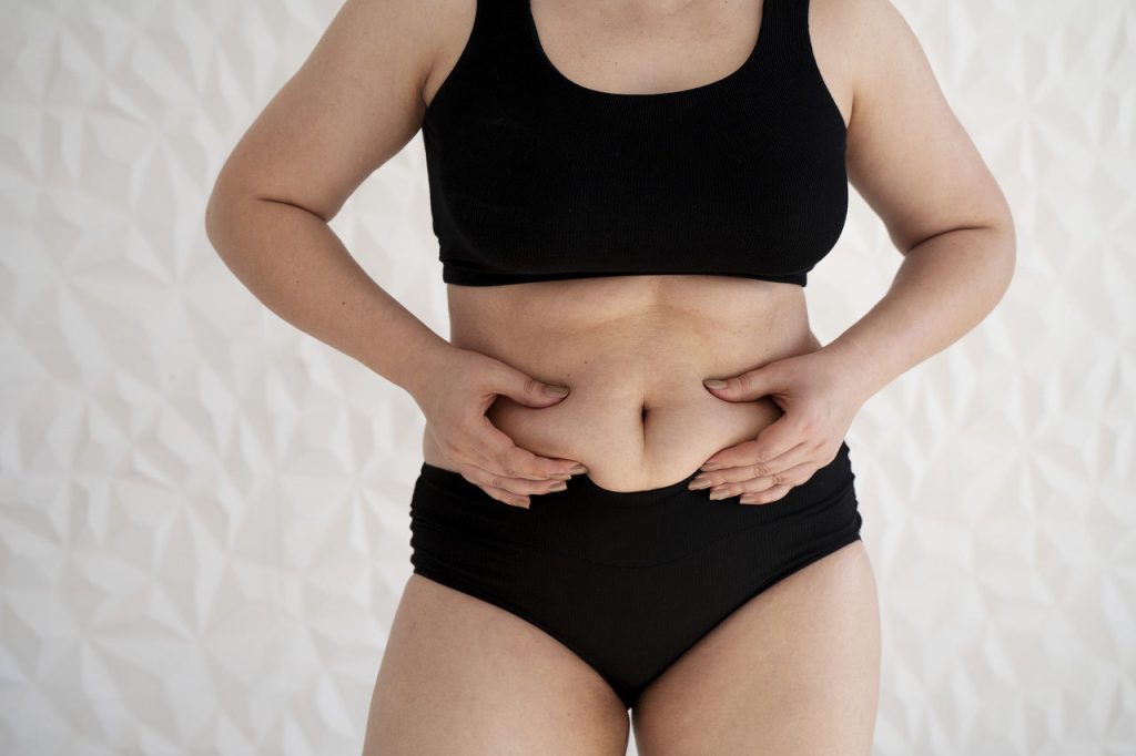 Cirurgião Plástico Goiânia - Acabe com as gorduras localizadas e flacidez com a Lipoabdominoplastia