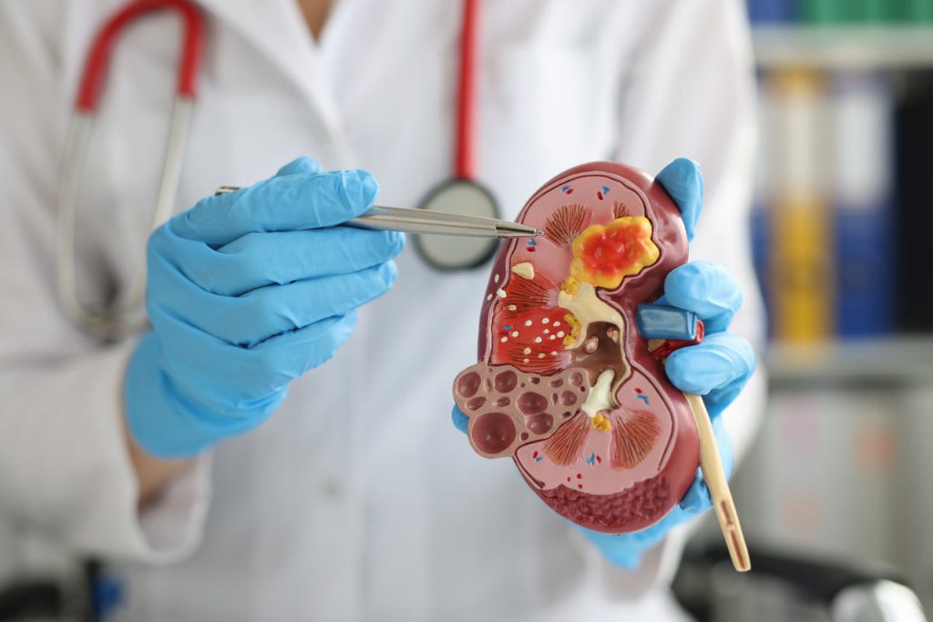 Urologia Goiânia - Câncer de rim é duas vezes mais frequente em homens do que em mulheres