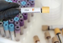Urologia Goiânia - PSA alto significa ter câncer de próstata?