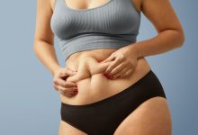 Cirurgia Plástica Goiânia - Qual é indicada para você: abdominoplastia ou lipoabdominoplastia?