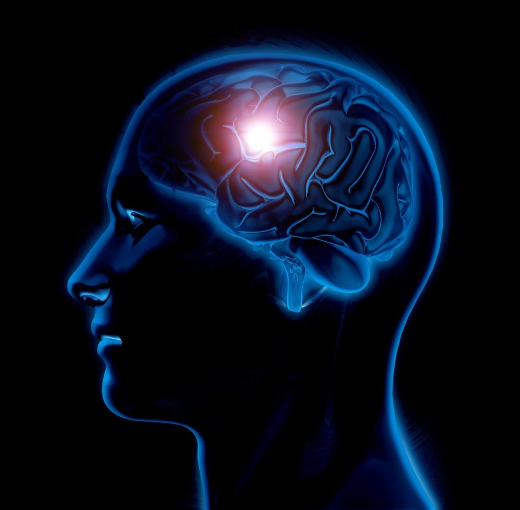 Centro de Imagem Aparecida de Goiânia - Angiotomografia de crânio no diagnóstico de aneurisma cerebral