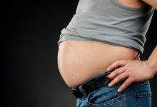 Clinica Urológica Goiânia - Obesidade pode trazer consequências para a saúde renal