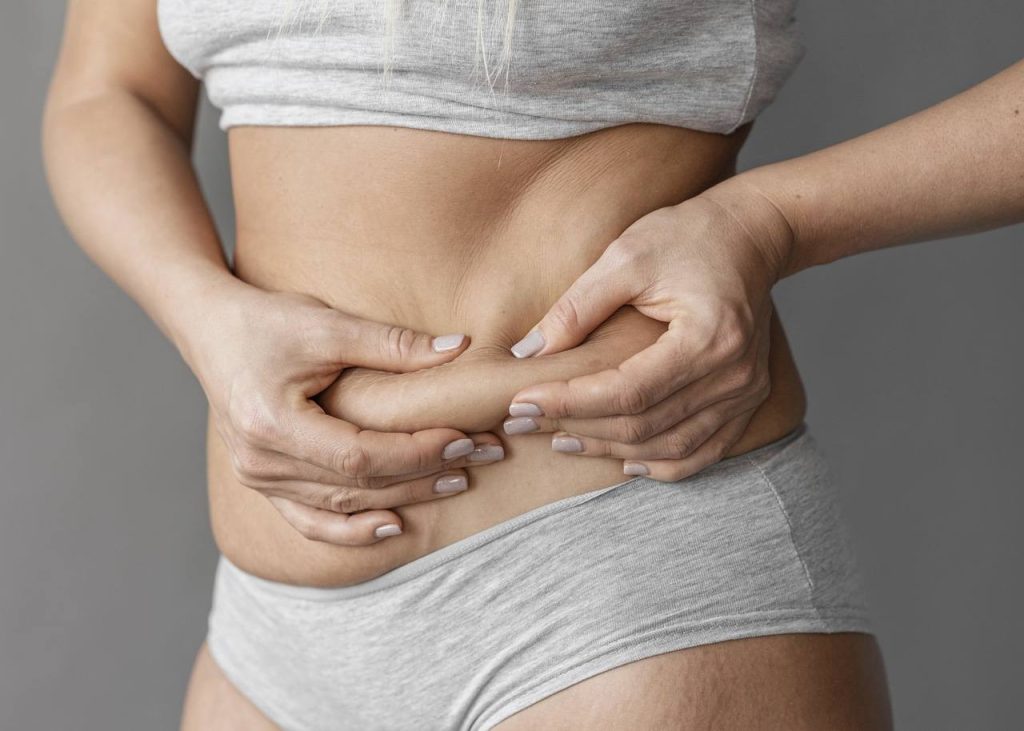 Cirurgia Plástica Goiânia - Tipos de abdominoplastia: conheça as técnicas mais modernas