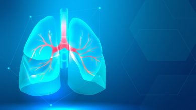 Centro de Imagem Aparecida de Goiânia - Indicação da biópsia pulmonar guiada por tomografia