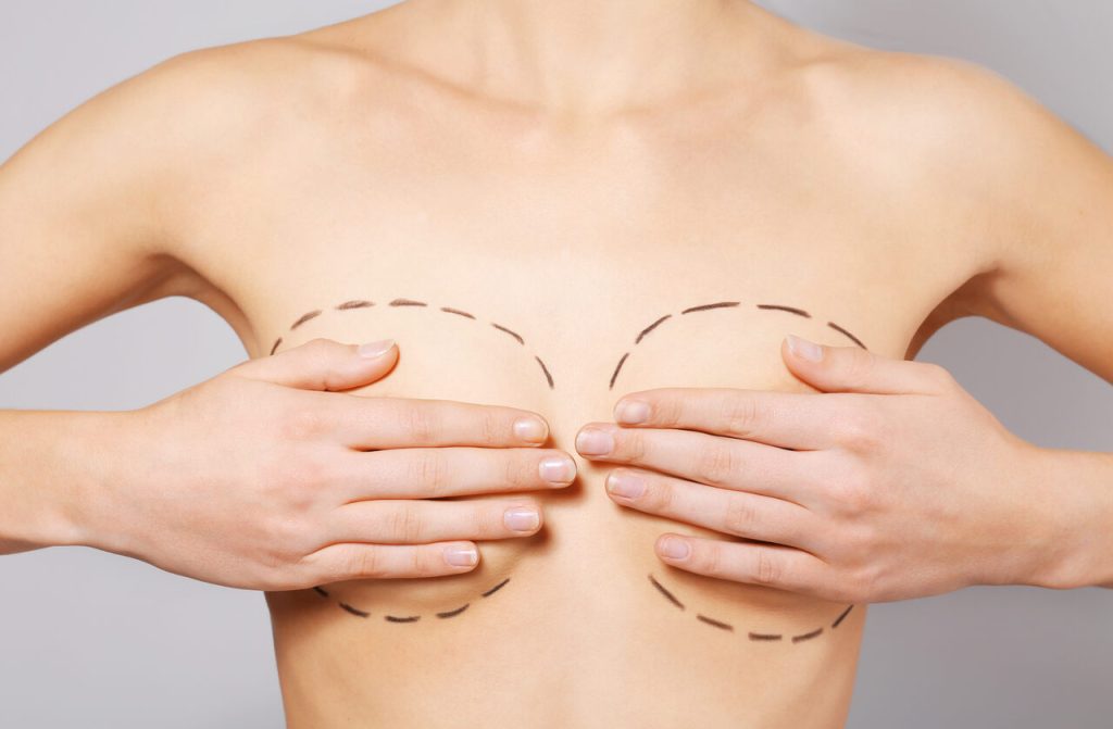 Cirurgia Plástica Goiânia - Conheça os tipos de mamoplastia