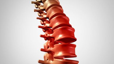 Clinica Ortopédica Goiânia - Qual a diferença entre escoliose, lordose e cifose?