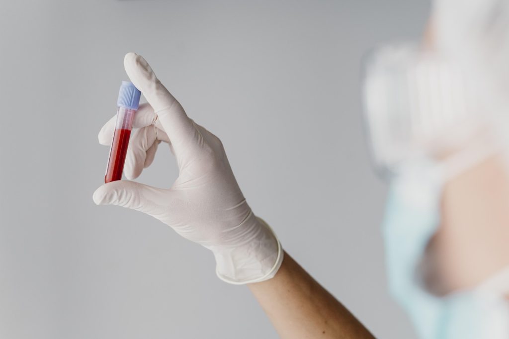 Jornal VER7 - Fiocruz desenvolve kit que detecta sangue infectado com malária
