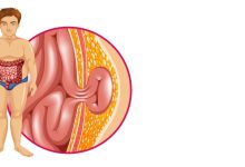 Urologia goiânia - Hérnia inguinal Tudo que você precisa saber sobre a cirurgia!