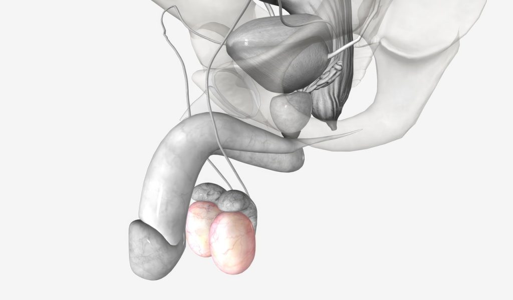 Urologista Aparecida de Goiânia - Torção testicular uma emergência urológica