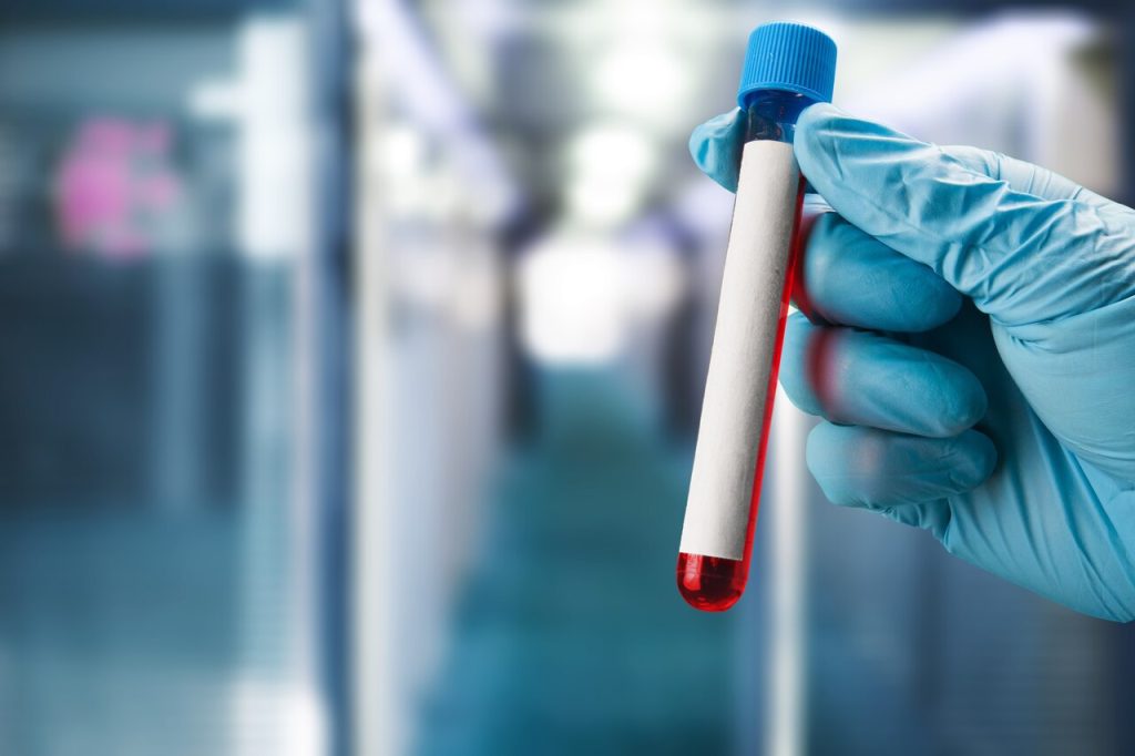 Urologia Goiânia - Já fez o exame de PSA este ano? Não deixe de fazer a prevenção do câncer de próstata!
