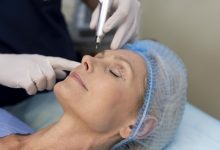 5 Fatores que pioram o aspecto da cicatriz depois da cirurgia plástica