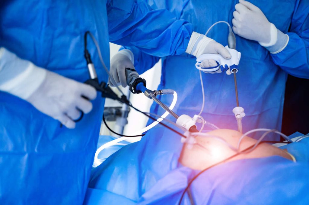 Urologia Aparecida de Goiânia - Vantagens da cirurgia laparoscópica para o câncer de próstata