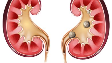 Ureterorrenolitotripsia rígida: conheça os benefícios dessa cirurgia