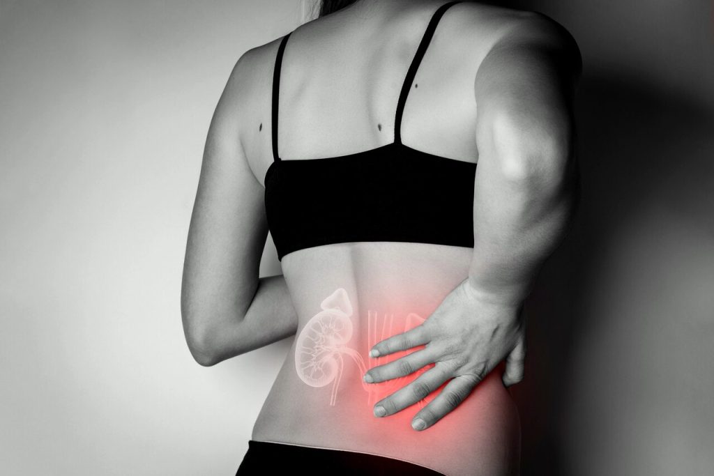 Urologia Goiânia - Mitos e verdade sobre pedra nos rins