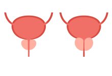 Urologia Goiânia - Como é feita a cirurgia ressecção transuretral da próstata?