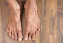 Lar para Idosos Goiânia - Cuidados essenciais a ter com os pés dos idosos