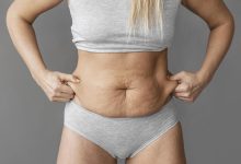 Mommy Makeover: a cirurgia plástica da mulher após a gestação!