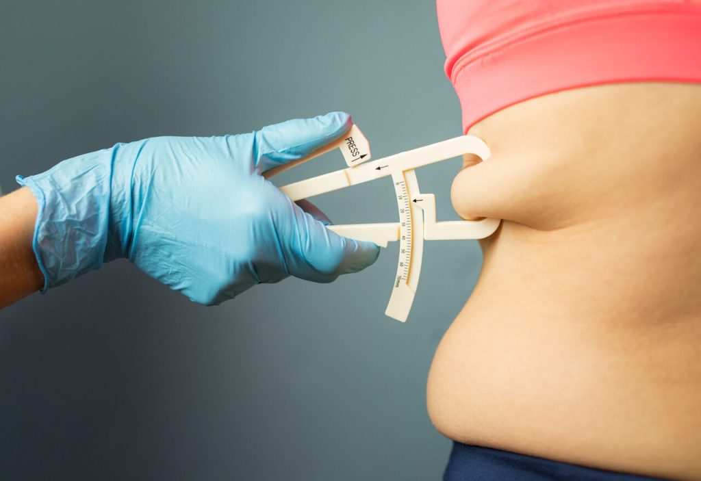 Cuidados necessários após a cirurgia bariátrica