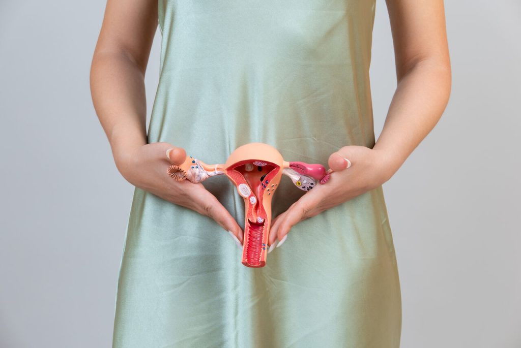 4 Mioma uterino saiba quais sao os sintomas e tratamentos
