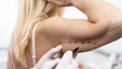 Cirurgia plástica após a perda de peso: como lidar com o excesso de pele!