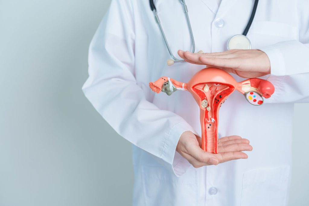 Dr João Batista Pinto Goiânia - Você sabia que o câncer de colo do útero é o terceiro tumor mais frequente entre as mulheres?