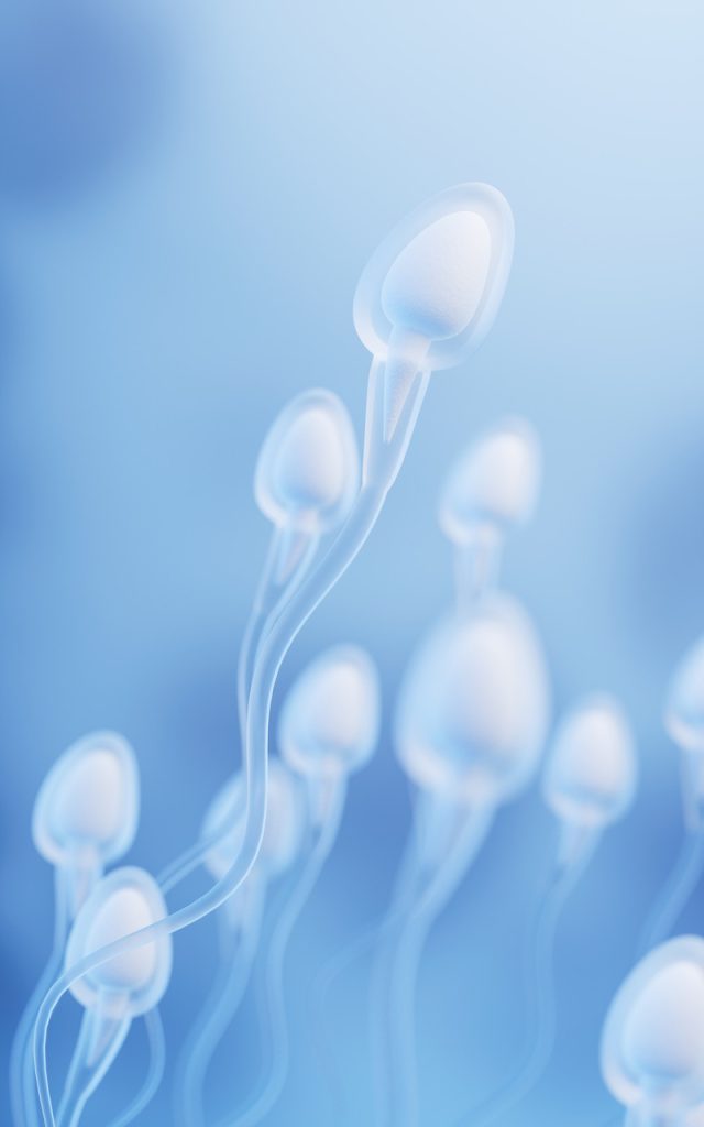 5 - Varicocele pode causar queda de testosterona e prejudicar a fertilidade?