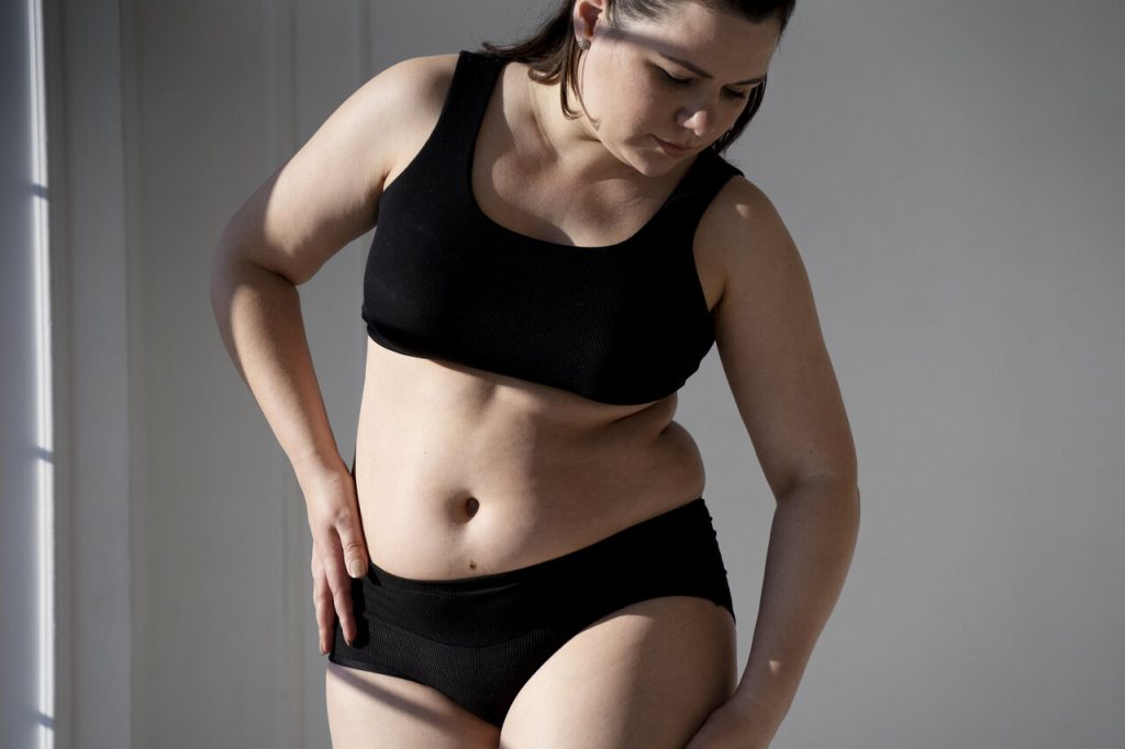 Goiânia: Dr. Marcelo Soares - Quando fazer a correção de diástase com abdominoplastia?