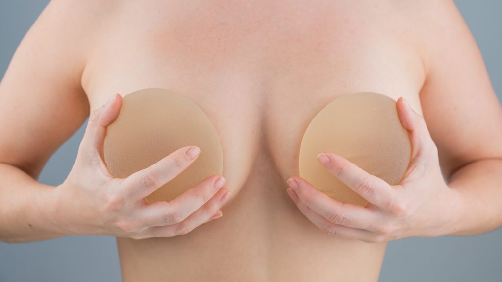 Dra Lorena Rosique Cirurgiã Plástica - Explante mamário saiba tudo sobre a remoção da prótese de silicone?