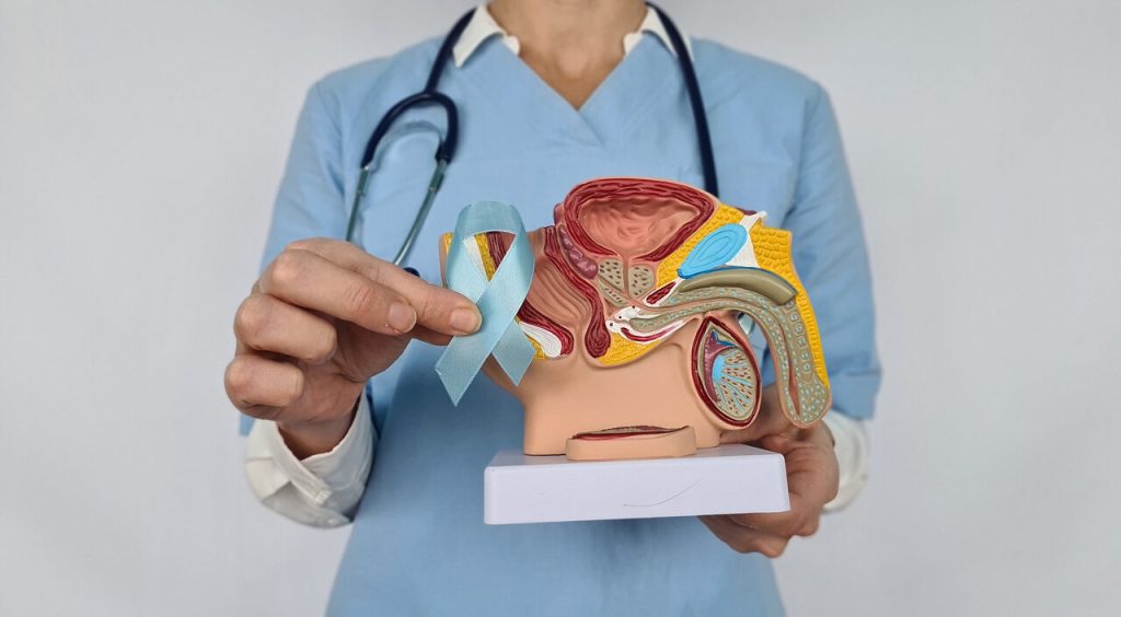 Conheça as técnicas de prostatectomia para o tratamento do câncer de próstata