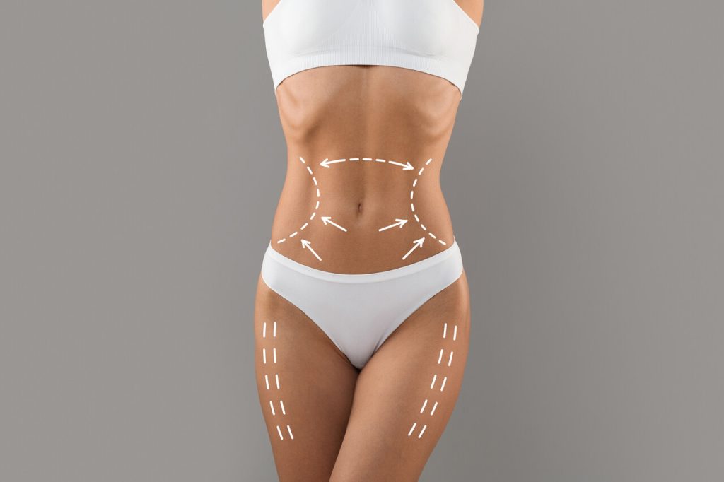 Lipoaspiração ou Lipoescultura: qual a melhor opção?