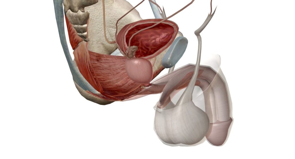 Quando é indicada a prostatectomia radical e quais as opções de técnicas cirúrgicas