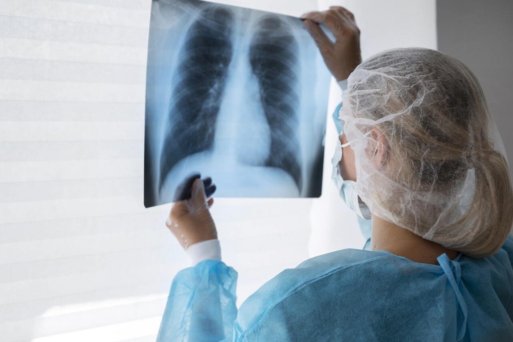 Importância da radiografia de tórax no atendimento emergencial