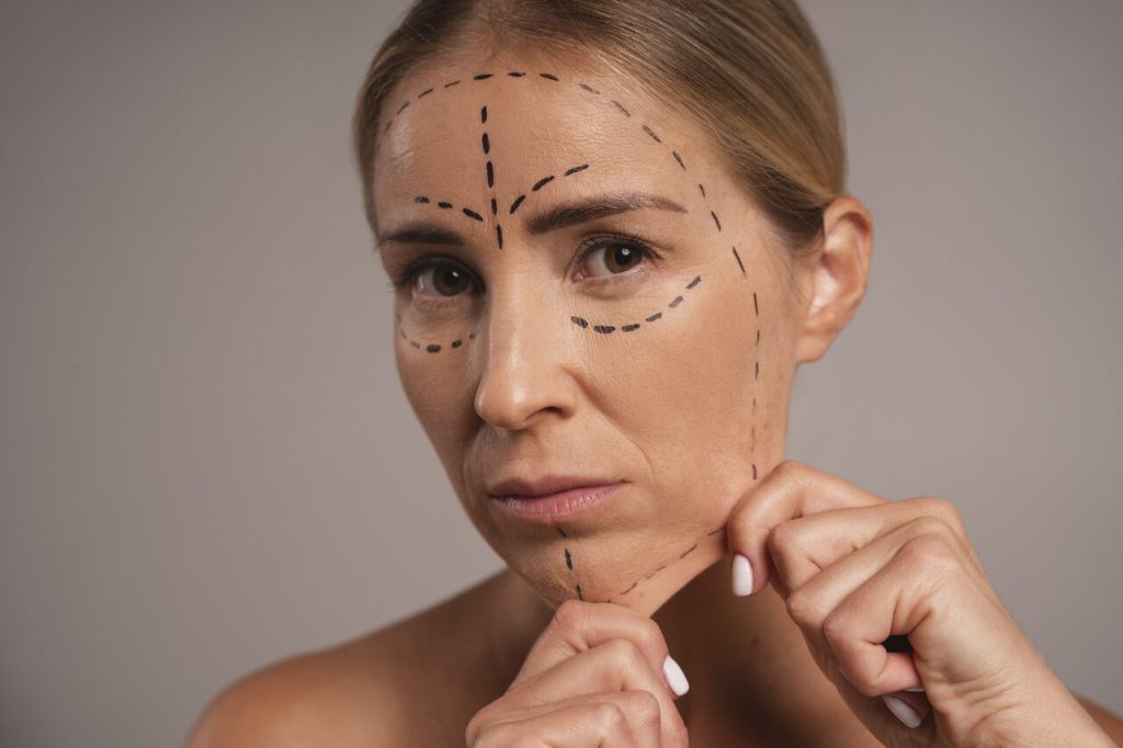 Dr. Reyner Abrantes Stival - Quais as vantagens de combinar ritidoplastia e blefaroplastia?