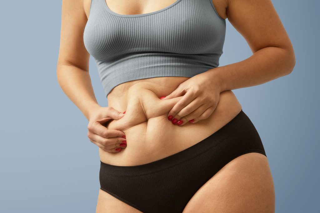 Posso fazer abdominoplastia mais de uma vez?