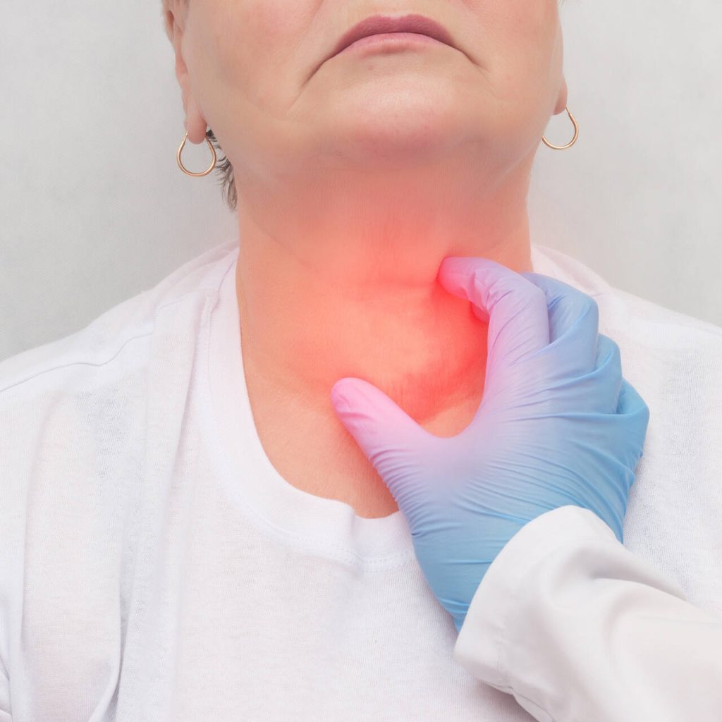 Fui diagnosticado com nódulo na tireoide, preciso fazer punção guiada por USG?