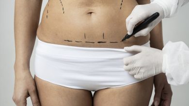 Cirurgião plástico Brasília: Como as cicatrizes evoluem ao longo do tempo e o que pode ser feito para minimizá-las?