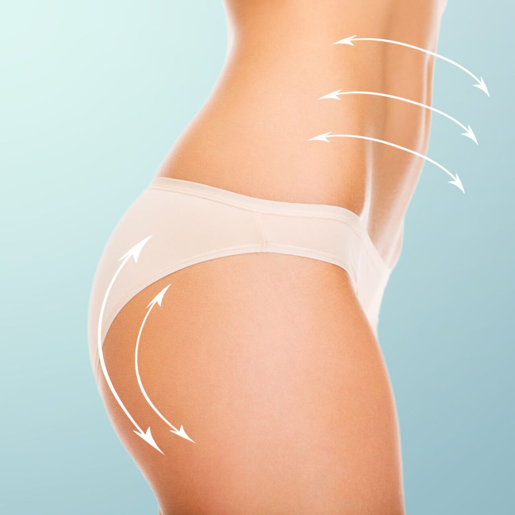 É possível realizar abdominoplastia e enxerto de gordura nos glúteos ao mesmo tempo?