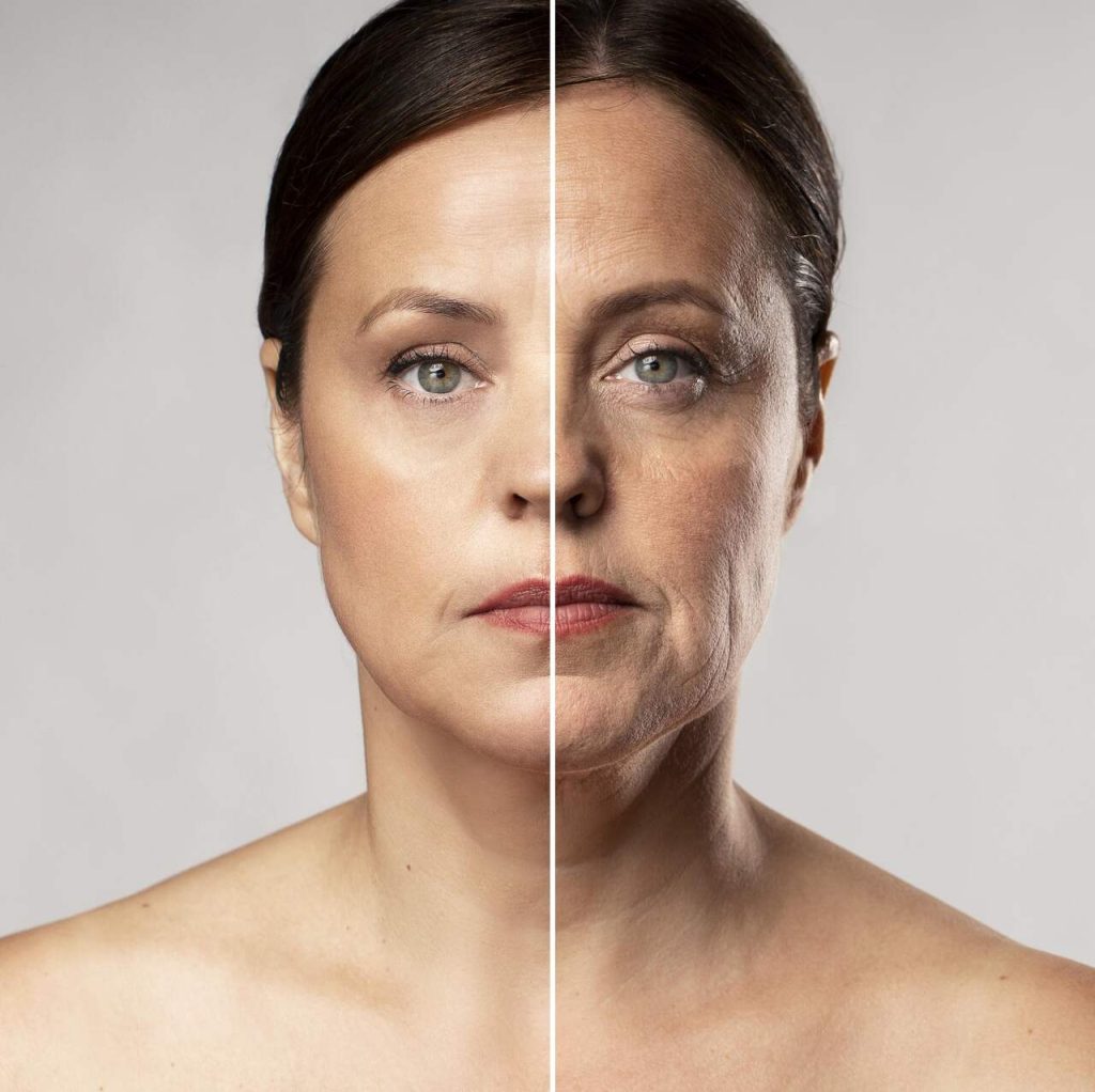 Cirurgião plástico Brasília: A flacidez fácil tem impactado sua autoestima? Descubra o poder do Lifting Facial!