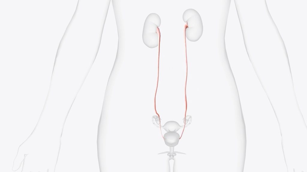 Calculo no ureter: sintomas e tratamentos!
