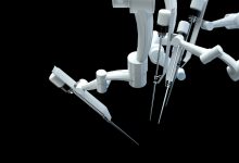 Diferença entre cirurgia robótica e cirurgia tradicional de próstata