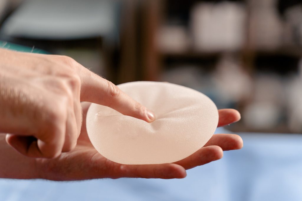 Implantes de Silicone e a Síndrome ASIA O Que Dizem os Estudos