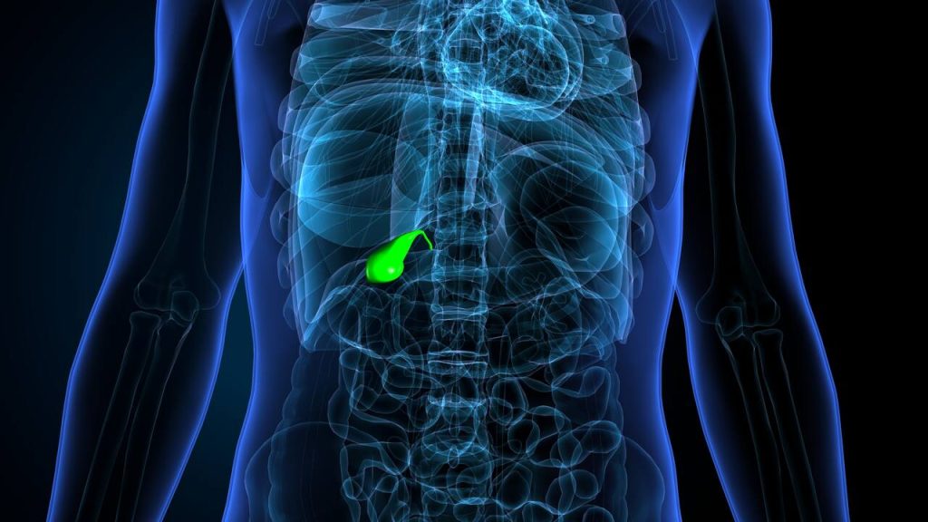Pedras na vesícula quando a única solução é a cirurgia