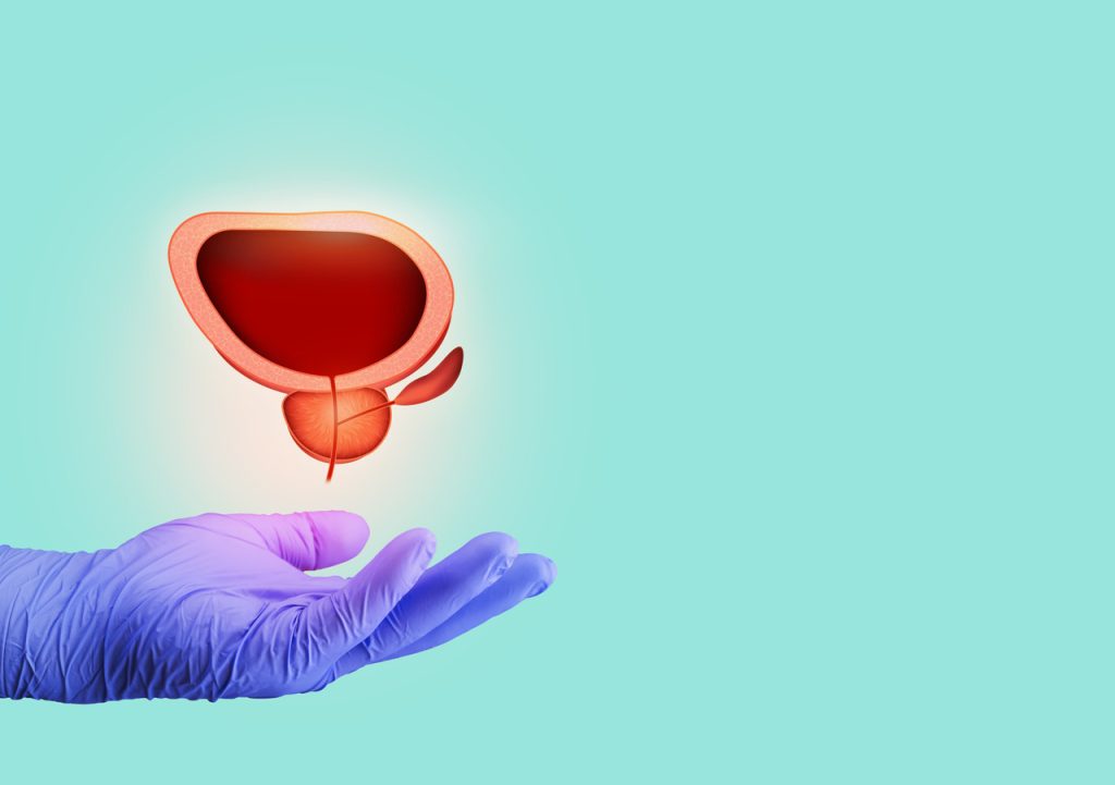 HoLEP no tratamento da próstata aumentada Dr. Marco Túlio Cruvinel, urologista em Goiânia, explica como funciona a técnica a laser